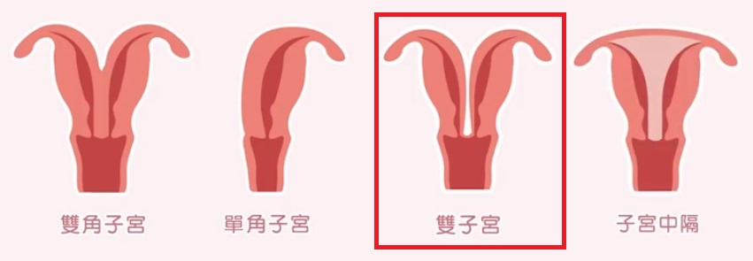 子宮介紹