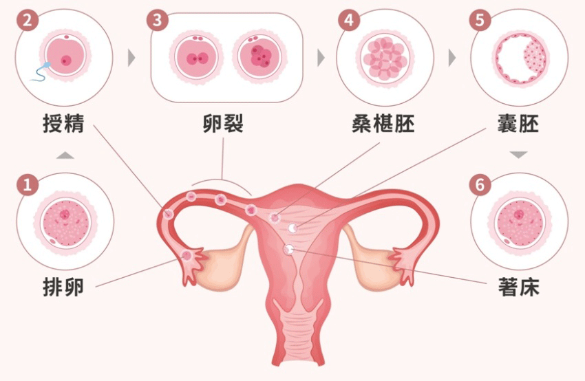 四種先天子宮結構異常