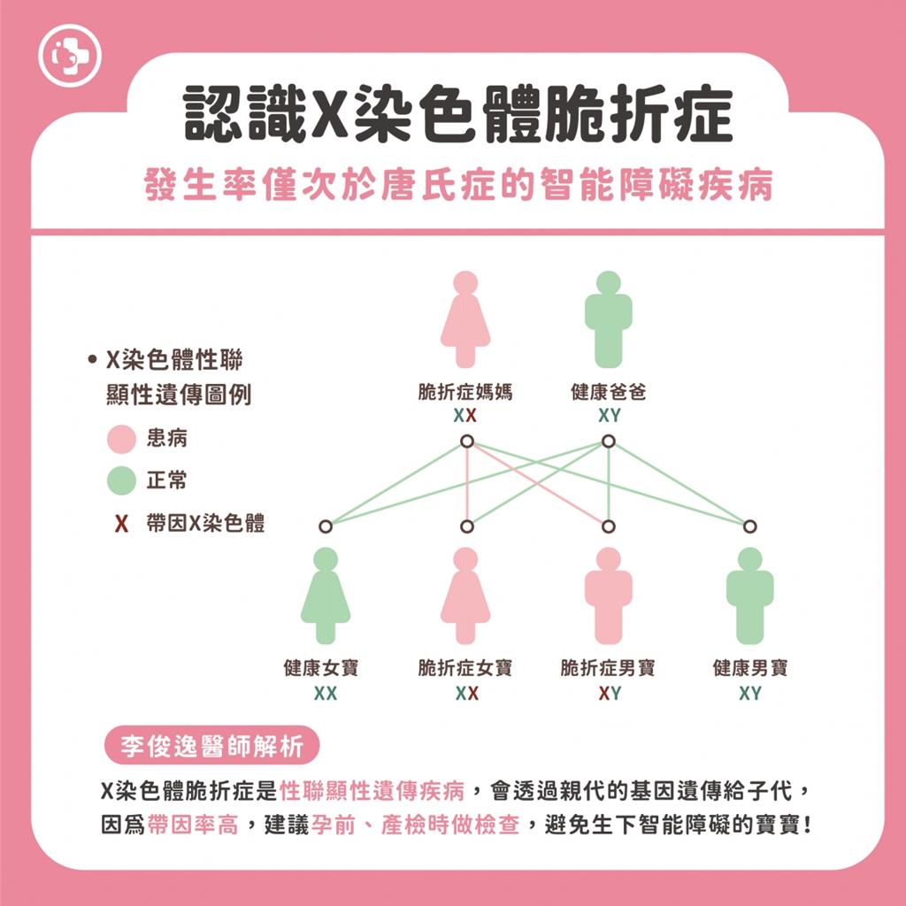 認識X染色體脆折症