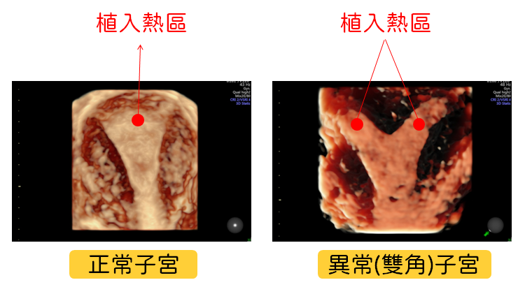 照片3 照片3