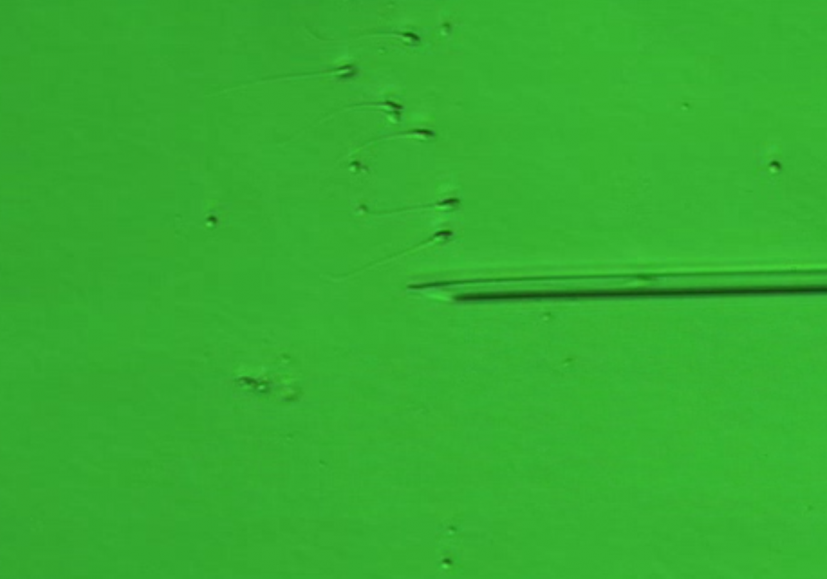 於高倍率顯微鏡下篩選外觀形態良好之精子進行顯微注射