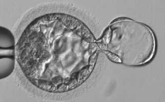 vacuoles(+)