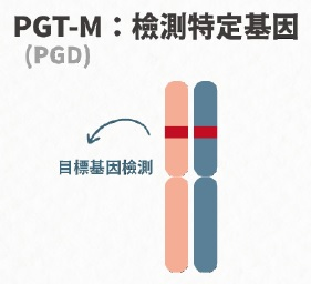 PGT-M:檢測特定基因
