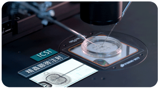 單一精蟲顯微注射術(ICSI) 單一精蟲顯微注射術(ICSI)