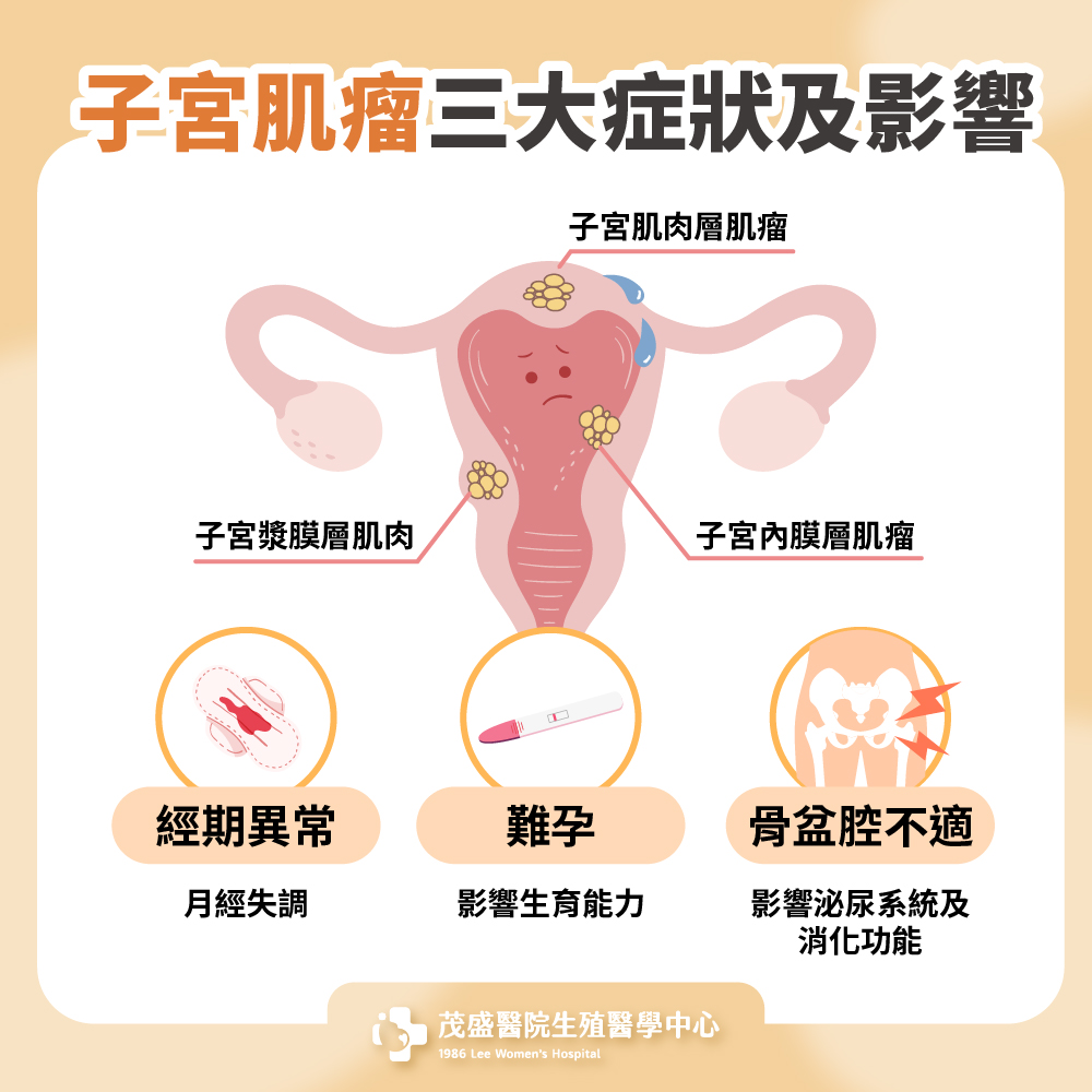 子宮肌瘤三大症狀及影響