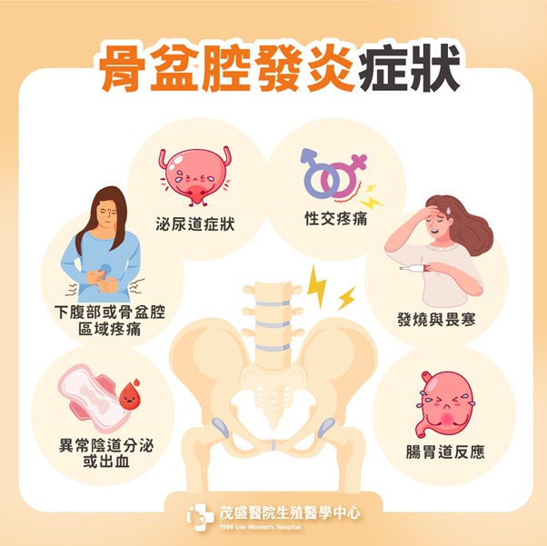 骨盆腔發炎症狀