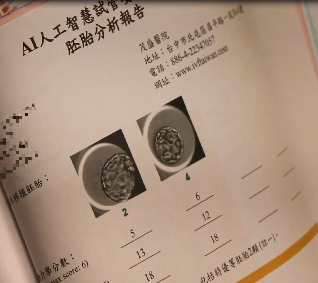 無精症 可能不是真的無精啊！