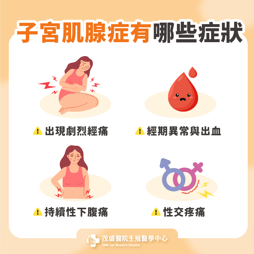 子宮肌腺症有哪些症狀