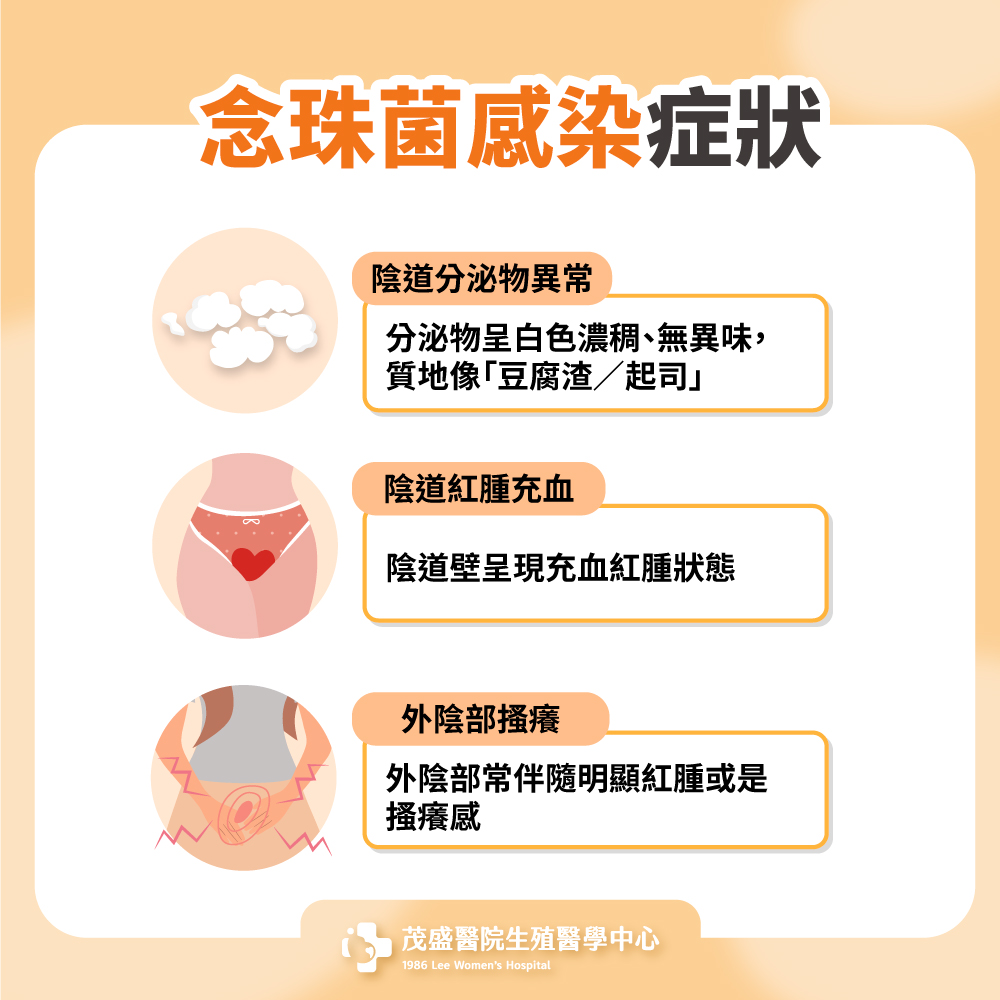 念珠菌感染症狀