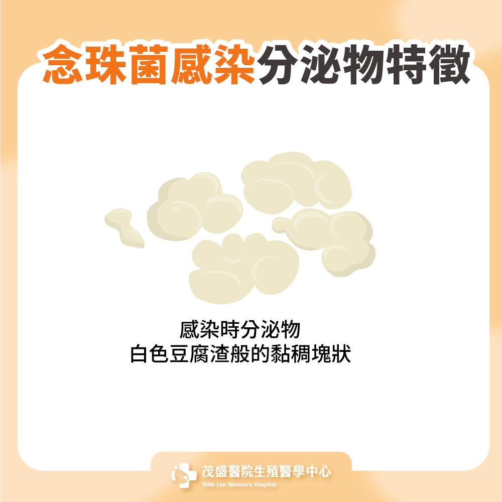 念珠菌感染分泌物特徵