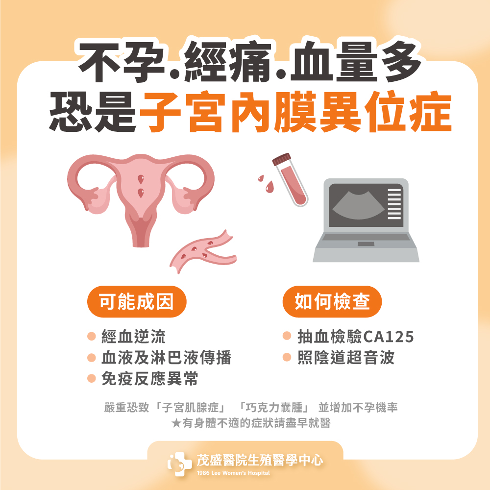 不孕.經痛.血量多恐是子宮內膜異位症