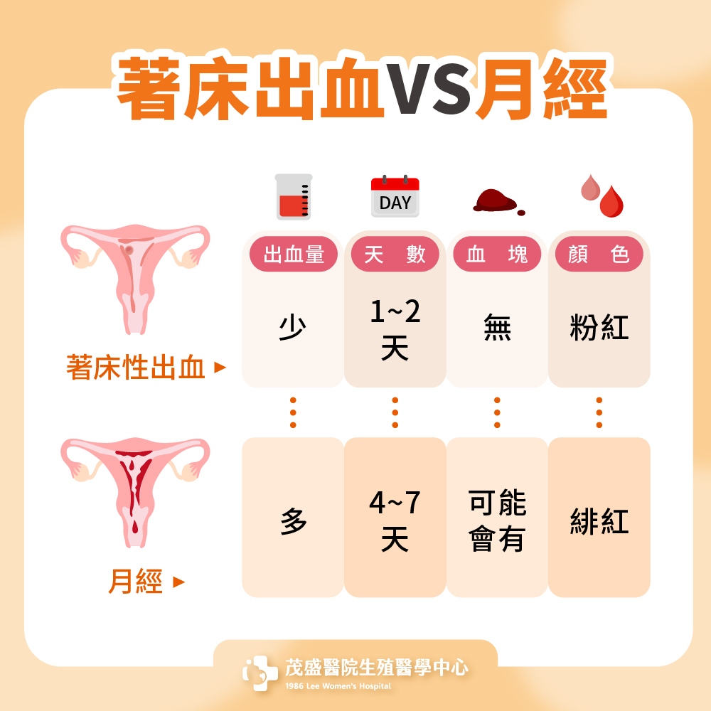 著床出血VS月經
