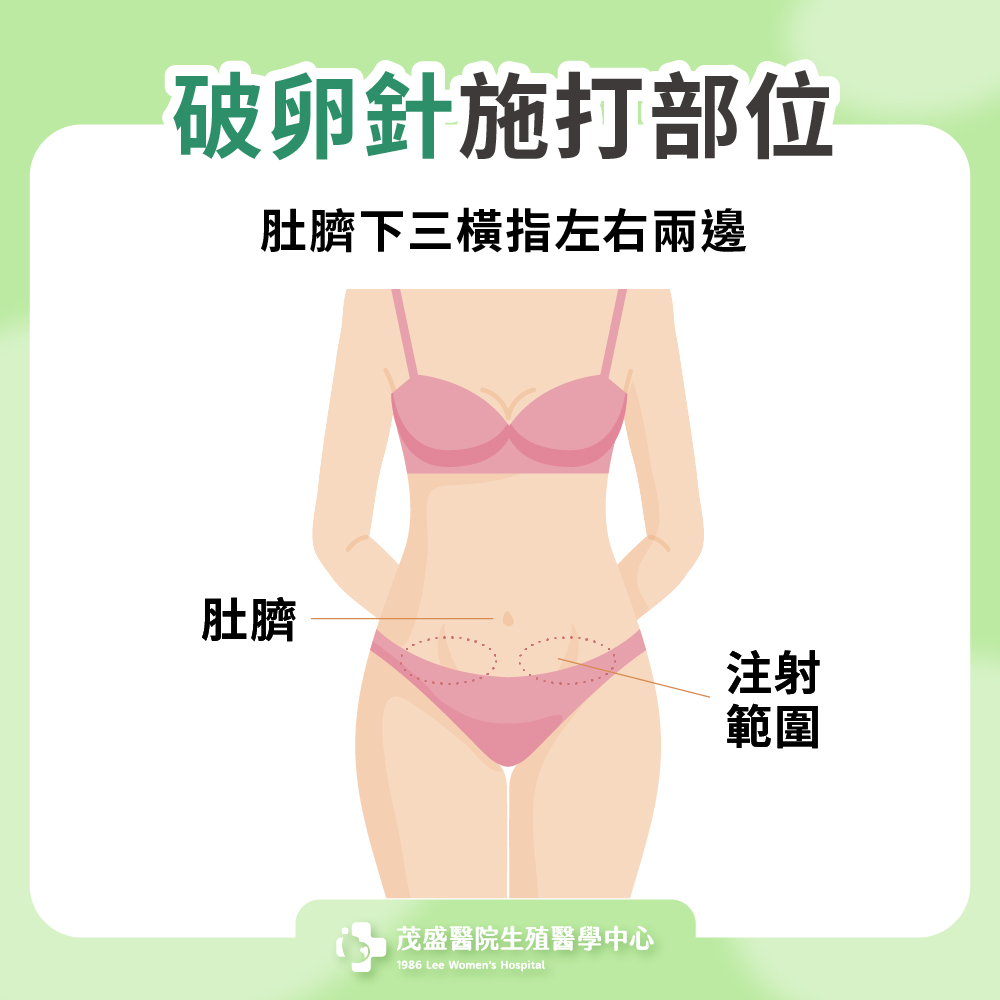 破卵針施打部位
