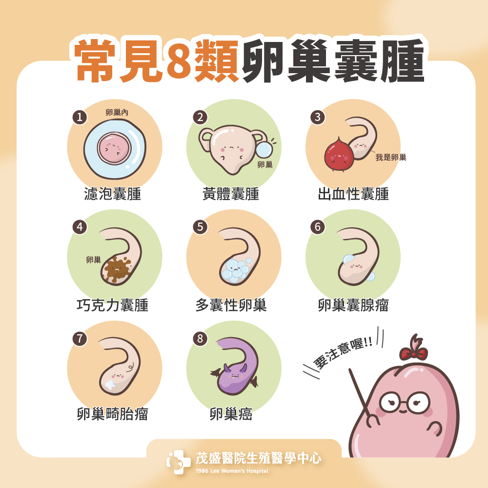 常見8類卵巢囊腫