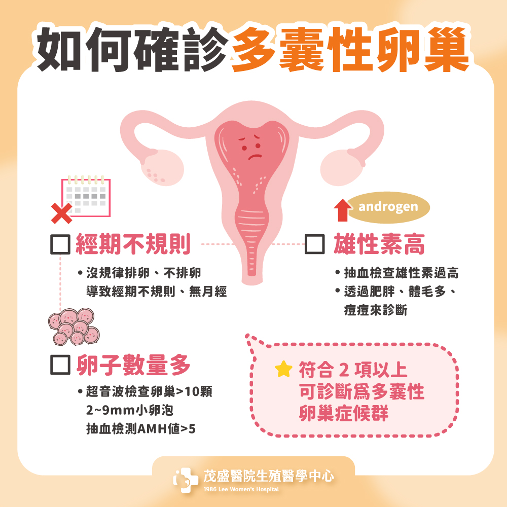 如何確診多囊性卵巢