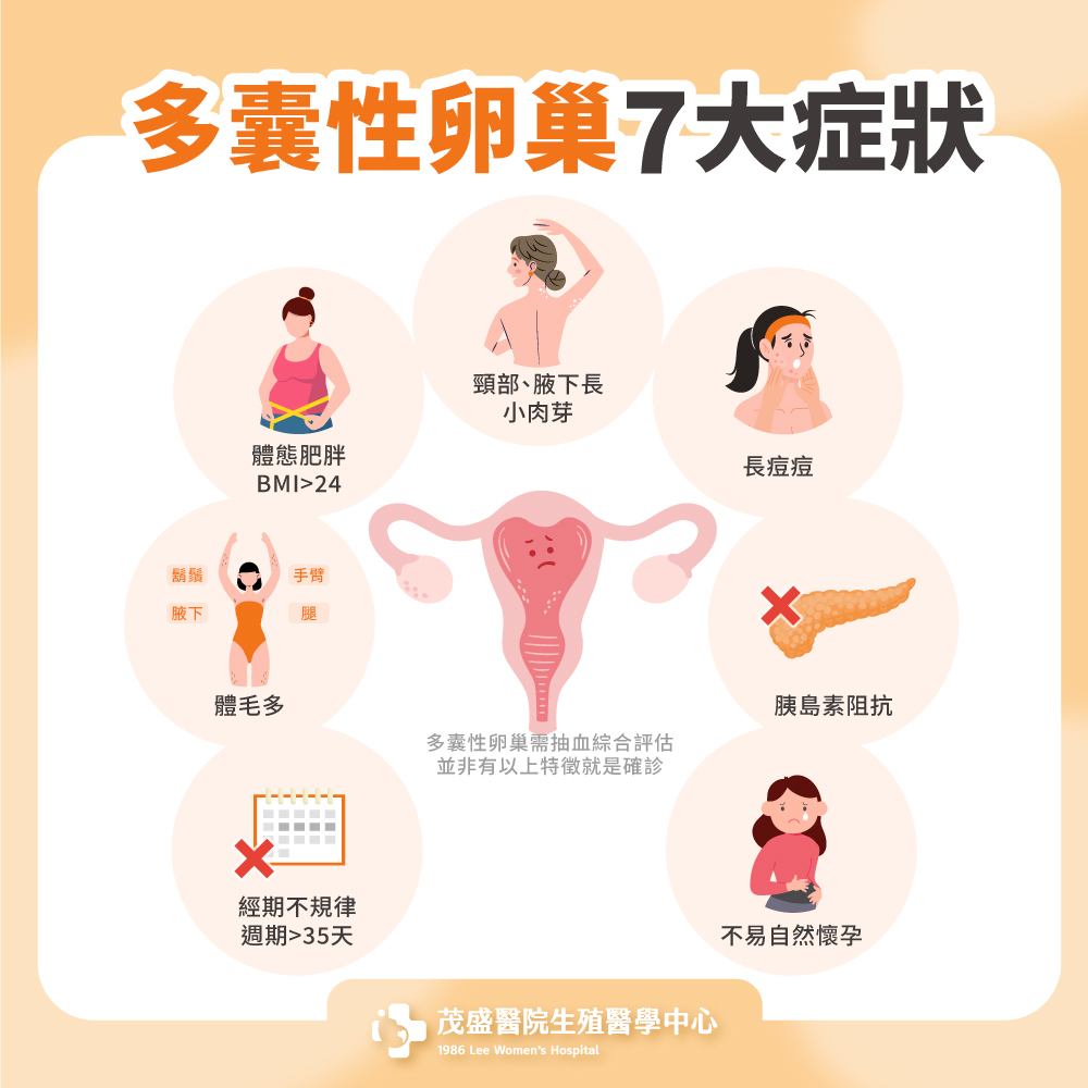 多囊性卵巢7大症狀