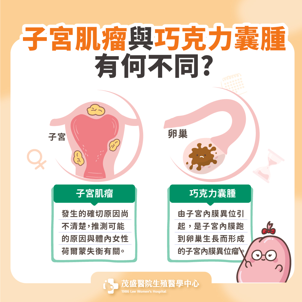 子宮肌瘤與巧克力囊腫有何不同?