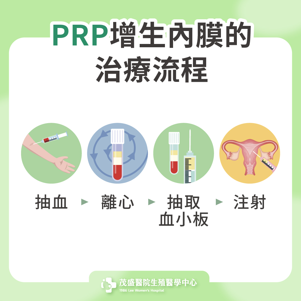 PRP增生內膜的治療流程