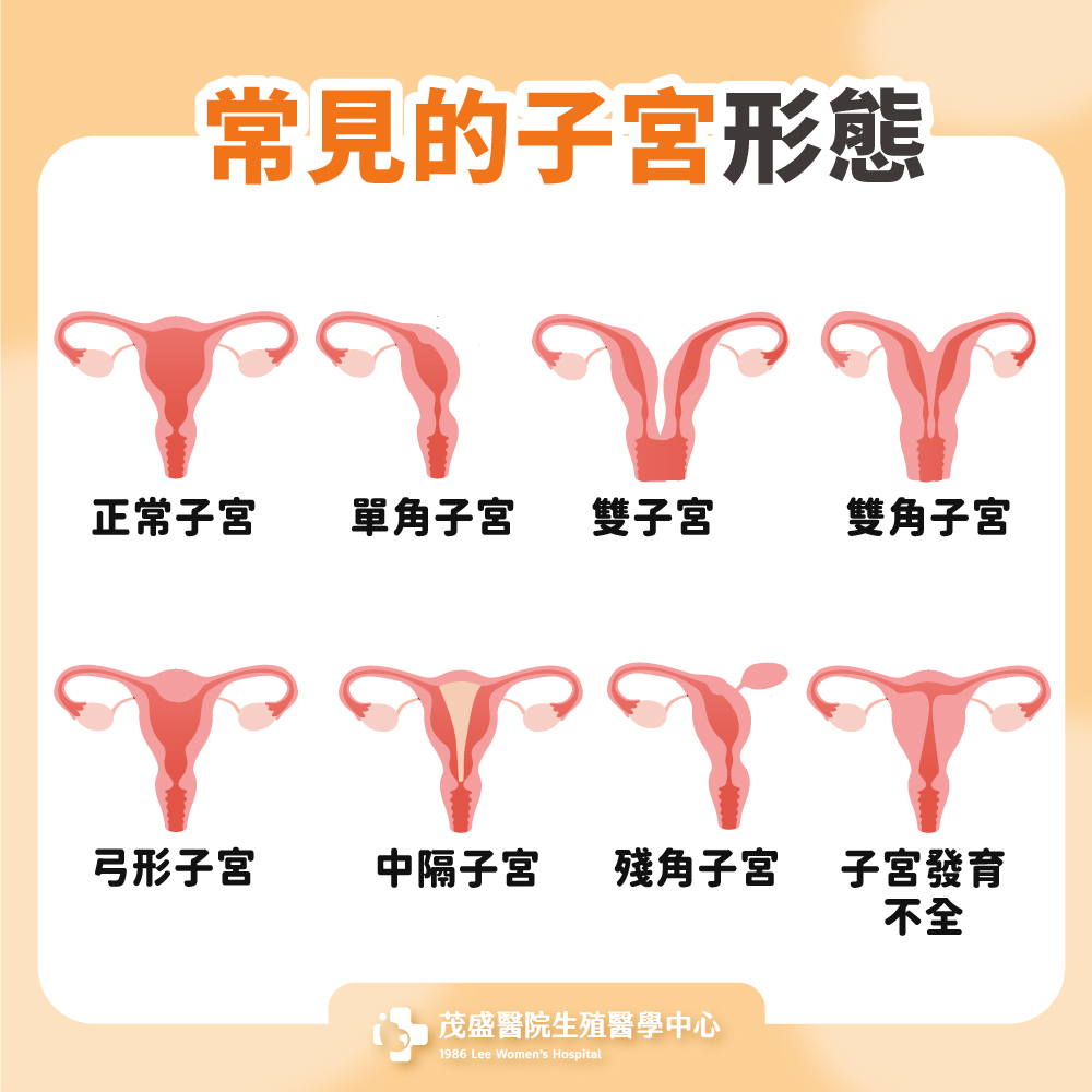 常見的子宮形態